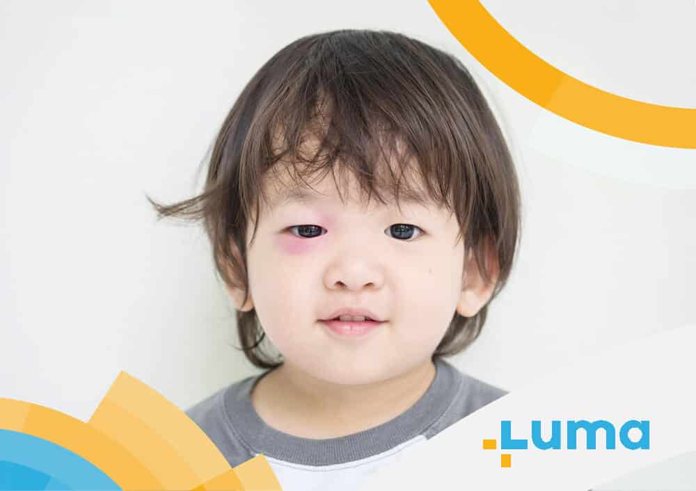 ภูมิแพ้ในเด็ก