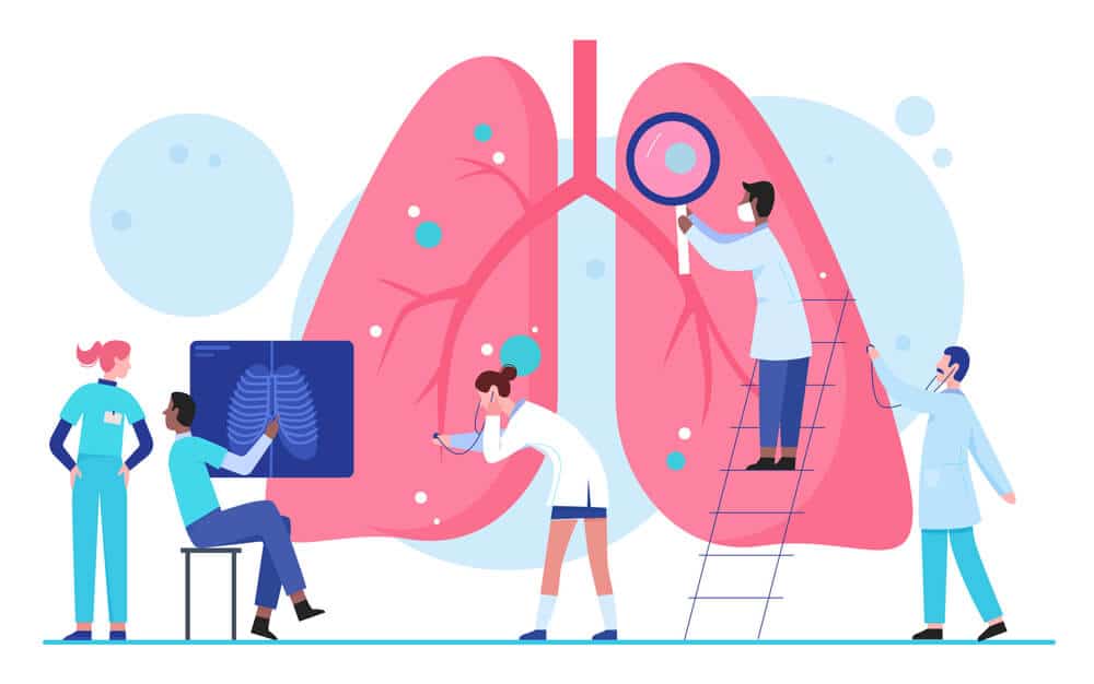 lung cancer